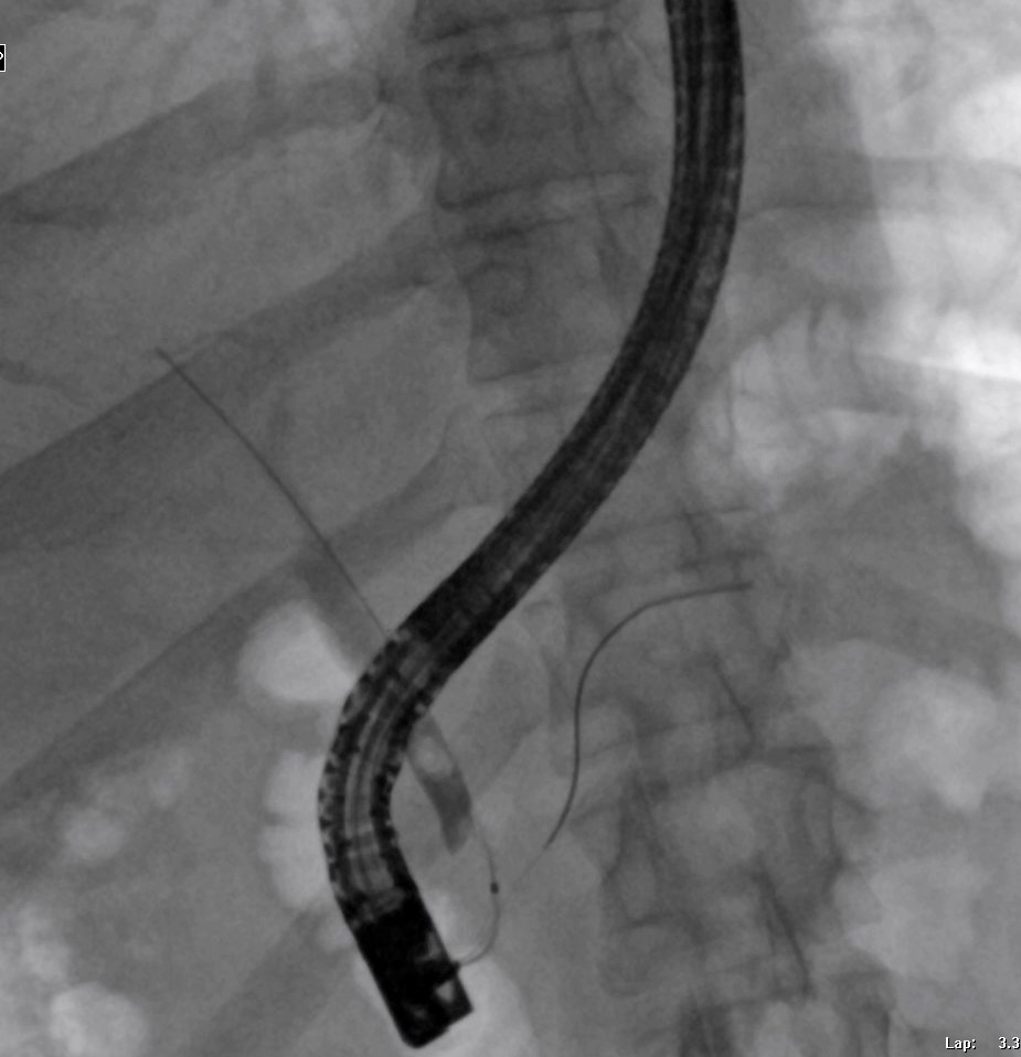 Sindh Institute of Advance Endoscopy & GI (SIAG) tweet media
