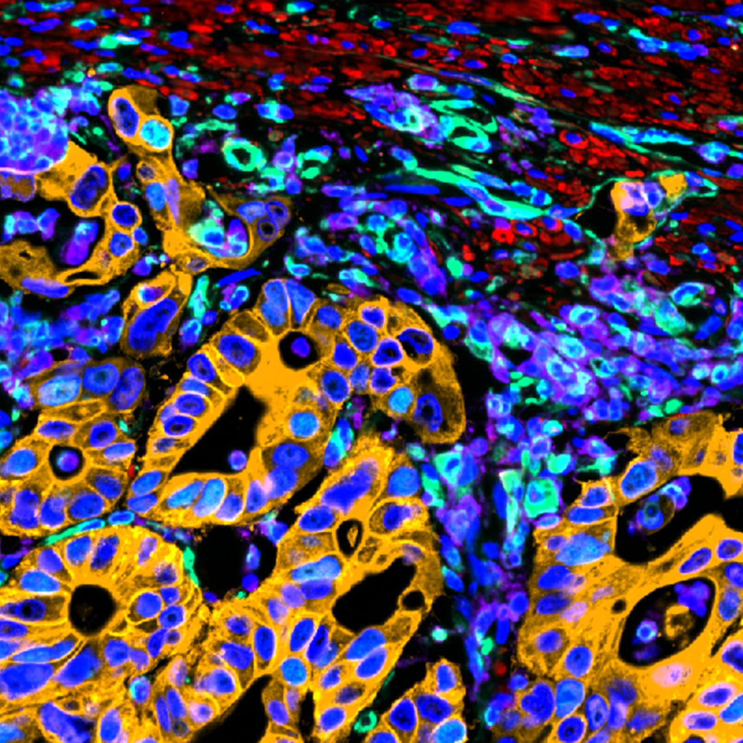 Empower your research endeavors with Aivia Community, a free software allowing you to easily open and interactively explore 2-to-5D microscopy data sets anywhere. 👉 aivia-software.com/aivia-community Colon adenocarcinoma tissue stained with 20+ markers, acquired on the Cell DIVE system.