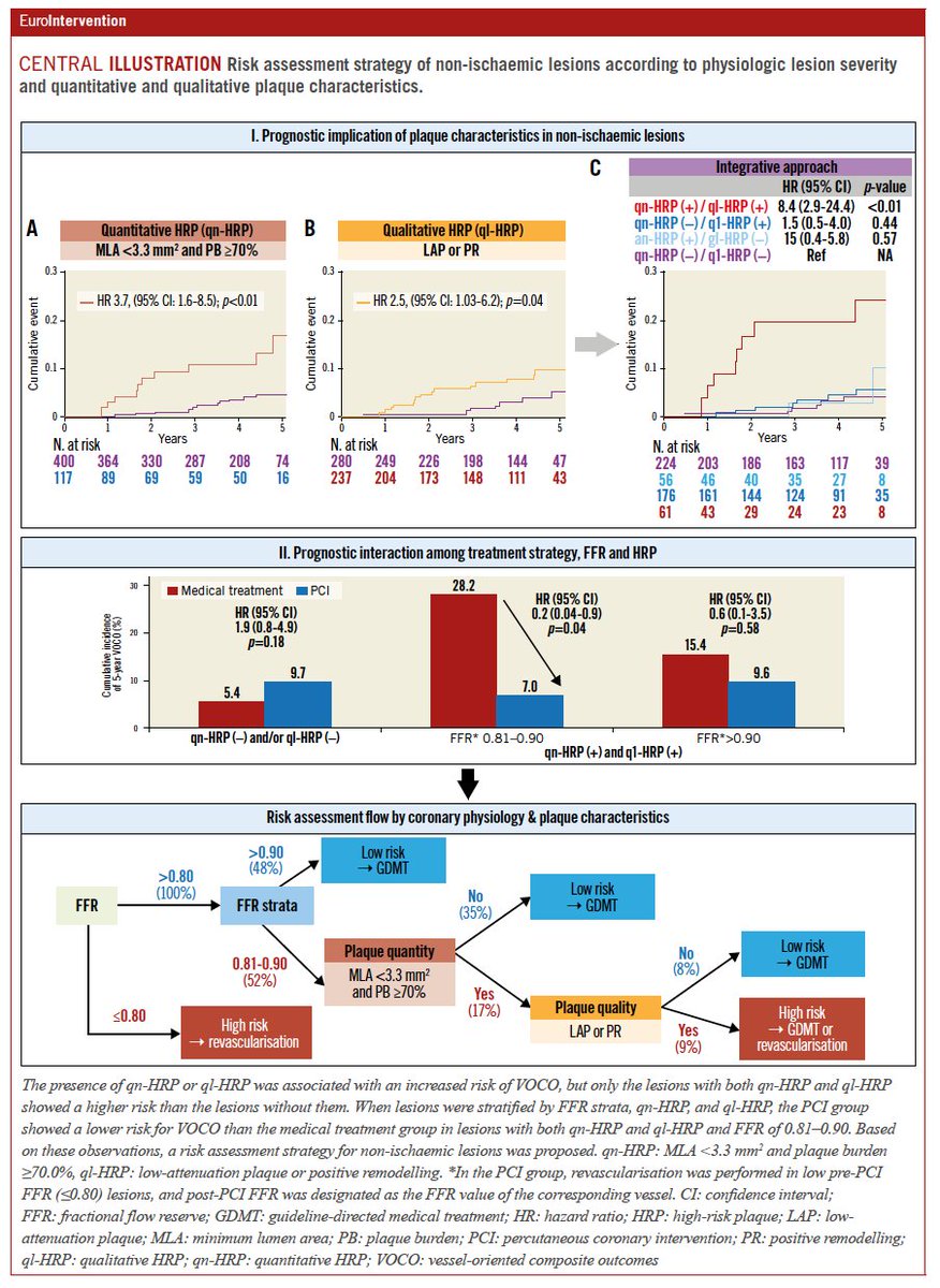 This study demonstrated that both quantitative and qualitative high-risk plaque features significantly influence clinical outcomes in coronary artery disease treated with FFR-guided strategies. Patients with high-risk plaques benefit more from PCI than medical therapy alone,…