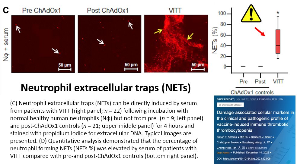 Neutrophil extracellular traps (NETs) & COVID-19 vaccine-induced immune thrombotic thrombocytopenia (VITT): jthjournal.org/article/S1538-… In my opinion, anyone who has had a COVID-19 vaccination should have their blood tested for NETs. Unfortunately, the tests are virtually unavailable