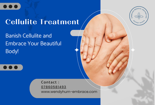 EmbraceByWH's tweet photo. Cellulite? Say goodbye! Our treatments target dimpled skin, boosting your self-esteem.
Regain body confidence with our services!
Discover the path to smoother skin - https://t.co/9j7LcZQIbD
#SmoothConfidence #Cellulite #EmbraceYourBody #Bristol https://t.co/VAavUJLTA3