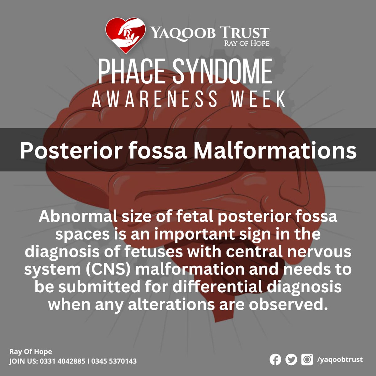 YaqoobTrust's tweet photo. PHACE Syndrome Awareness Week
Posterior fossa Malformations
#phace #share #explore #explorepage #yaqoobtrust #yt #awareness https://t.co/31vwWboOKZ