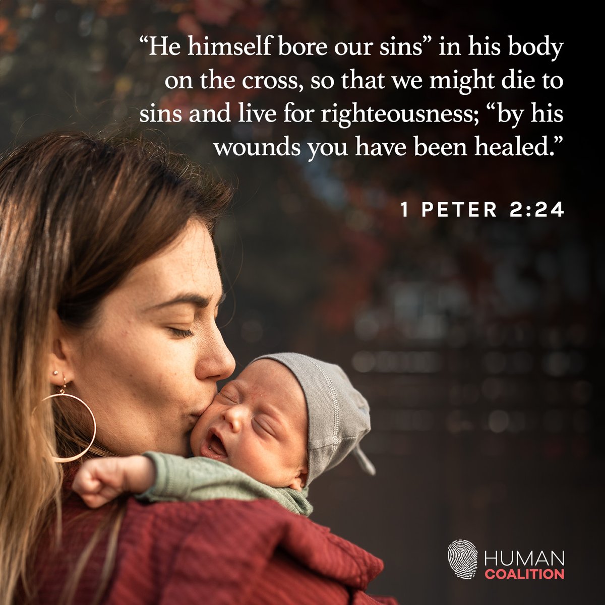 “He himself bore our sins” in his body on the cross, so that we might die to sins and live for righteousness; “by his wounds you have been healed.” 1 Peter 2:24 #SaveTheBabyHumans #LifeIsAHumanRight #ValueLife #ChooseLife #EndAbortion #Abortion #ProLife #RescueThePreborn