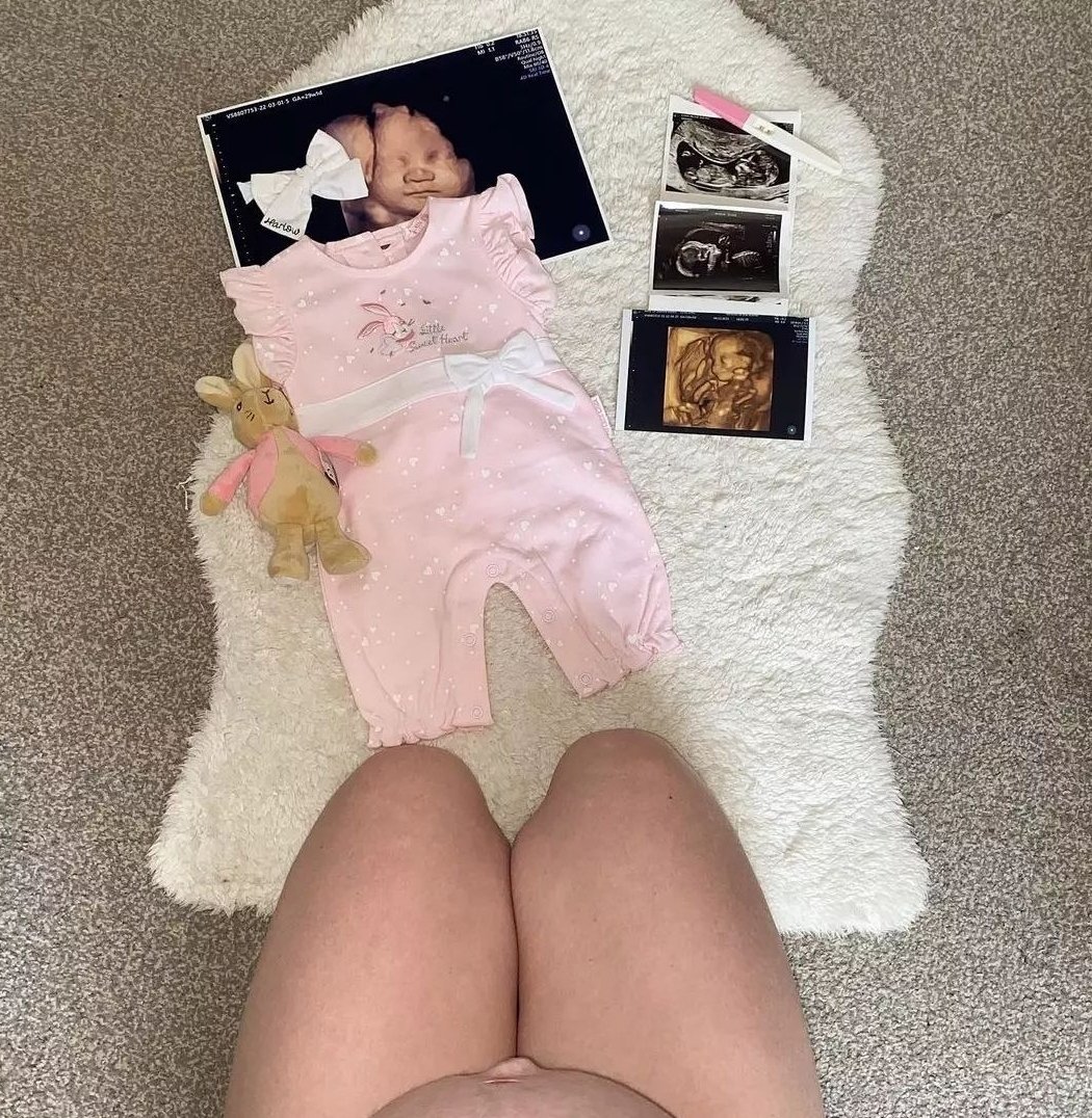 MiracleView3D4D's tweet image. Serving Arizona For 18+ Years For Elective Pregnancy Services. 

MiracleViewUltrasound.com 
480-421-BABY 

All services listed on our website including Current Specials ❤

#pregnant #pregnacy #itsaboy #itsagirl