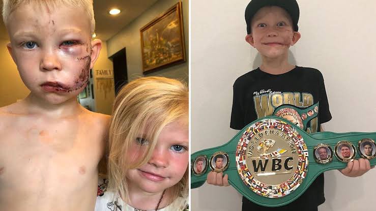 On July 9th, 2020, six-year-old Bridger Walker saved his little sister from a dog attack. He had 90 stitches all over his body, but saved his three-year-old sister from certain death. He stated, “If anyone has to die, it's me. I'm the big brother.” The World Boxing Council