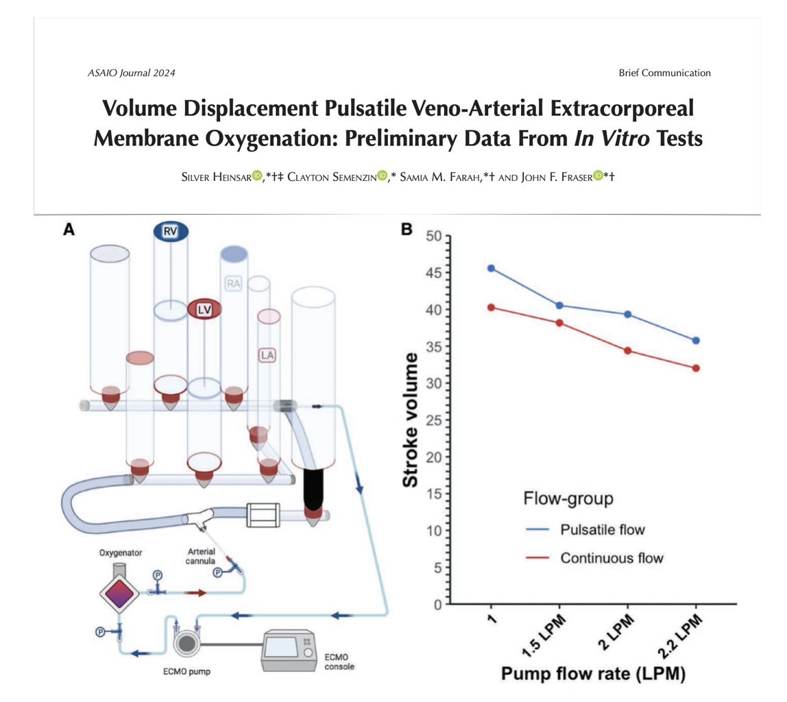 🔍 Volume displacement pulsatile VA #ECMO: study investigating novel pressure-sensitive #ECLS device. This preclinical experiment demonstrated surplus hemodynamic energy production/left ventricular unloading vs continuous-flow pump
#FOAMcc <a href="/asaiojournal/">asaiojournal</a>
🔓 bit.ly/3TFTfEp