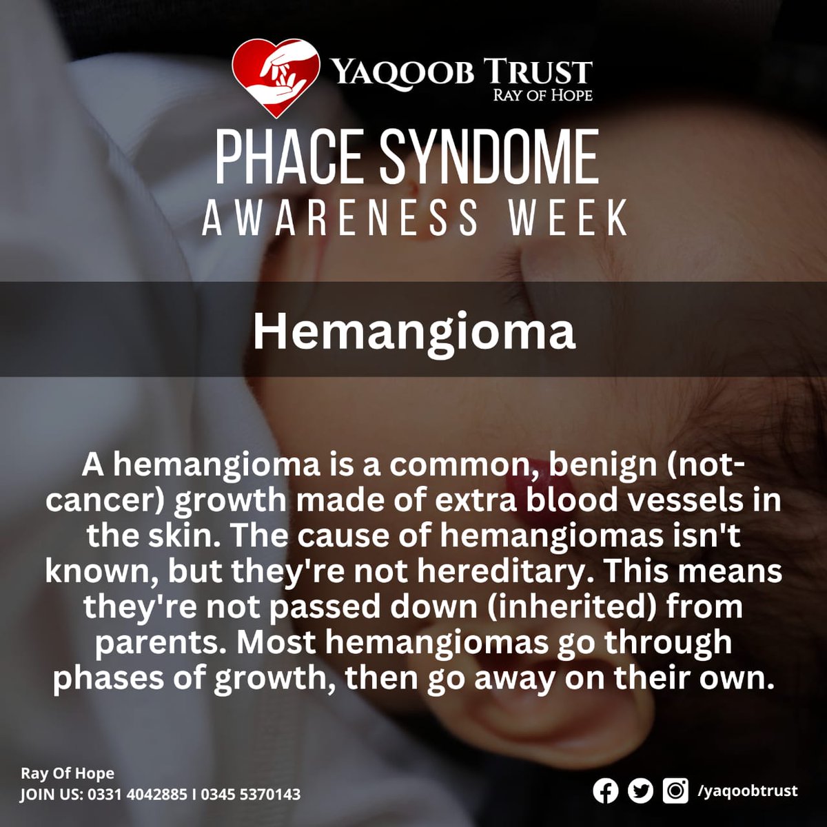 YaqoobTrust's tweet photo. PHACE Syndrome Awareness Week
#phace #share #explore #explorepage #yaqoobtrust #yt #awareness https://t.co/RRjuhm49lH