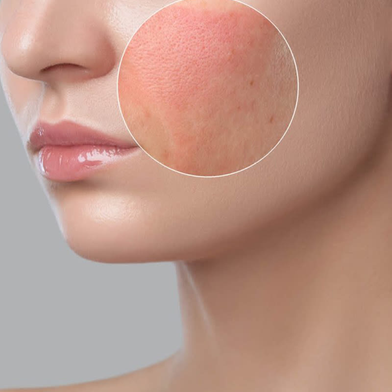 SkinBodyRenewal's tweet photo. Menopause And The Pillars Of Health: Less inflammation means smoother, happier skin and less discolouration and redness https://t.co/rAddwfp9qw
#SkinRenewalSA #DrMaureenAllem #PillarsOfHealth #Menopause#SkinGlow #IVozone #Detox #HealthySkin https://t.co/dDX2EH2VHF