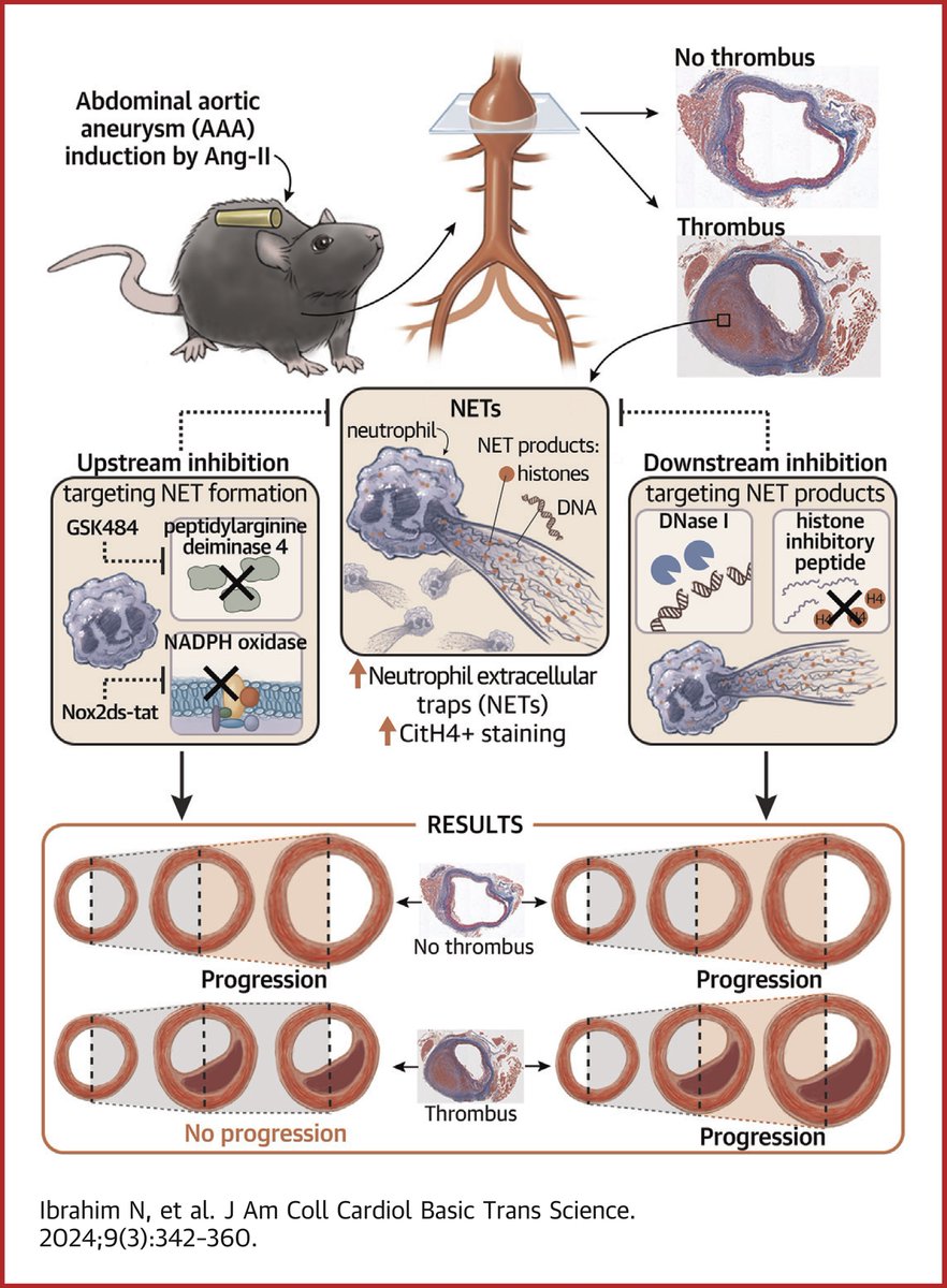 Preventing formation of neutrophil extracellular traps holds promise for pharmaceutical management of abdominal aortic aneurysms with a thrombus component. Read the new #JACCBTS study by Dr. Nahla Ibrahim, and colleagues: bit.ly/43AXupt