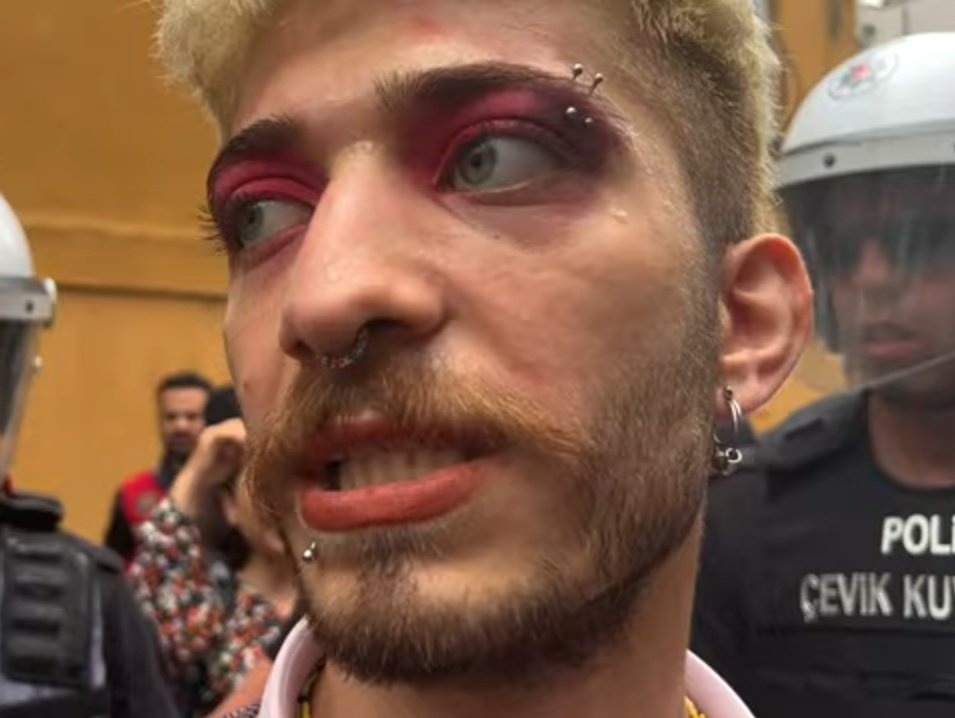 Zafer partisine oy vermeyen erkek🤣🤣🤣