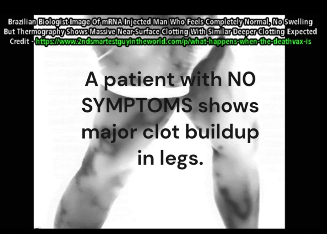 Brian G. Powell,M.S. tweet media