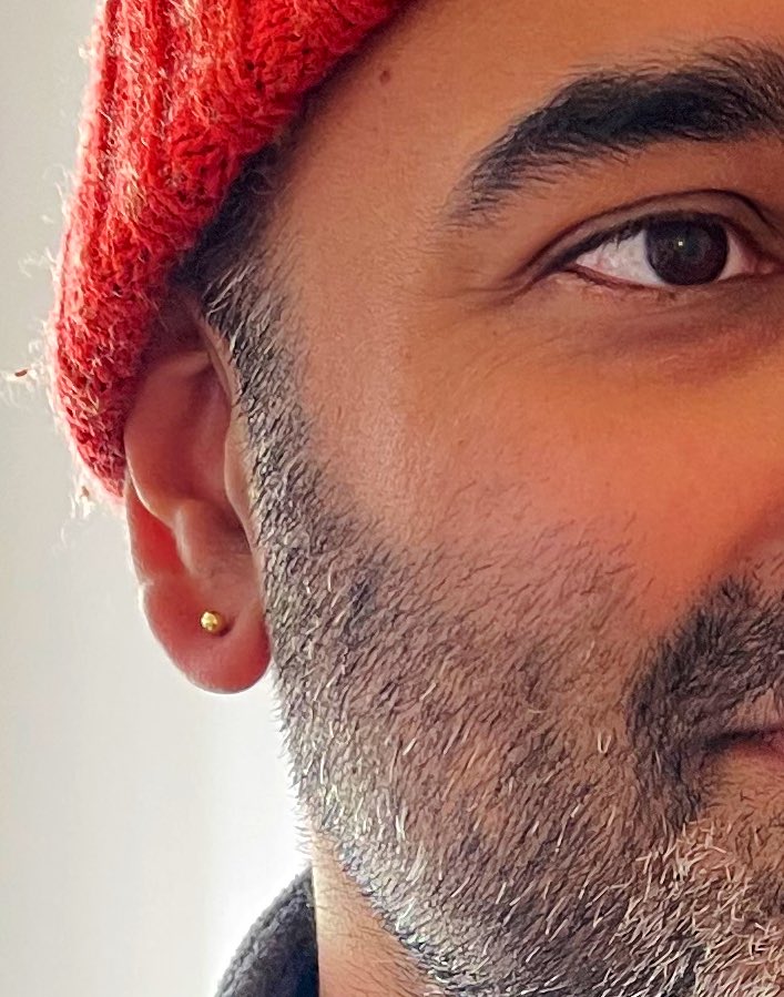 DrPimPim's tweet photo. @sleepy__doc Do it! Just had mine done https://t.co/j9AbSndlqi