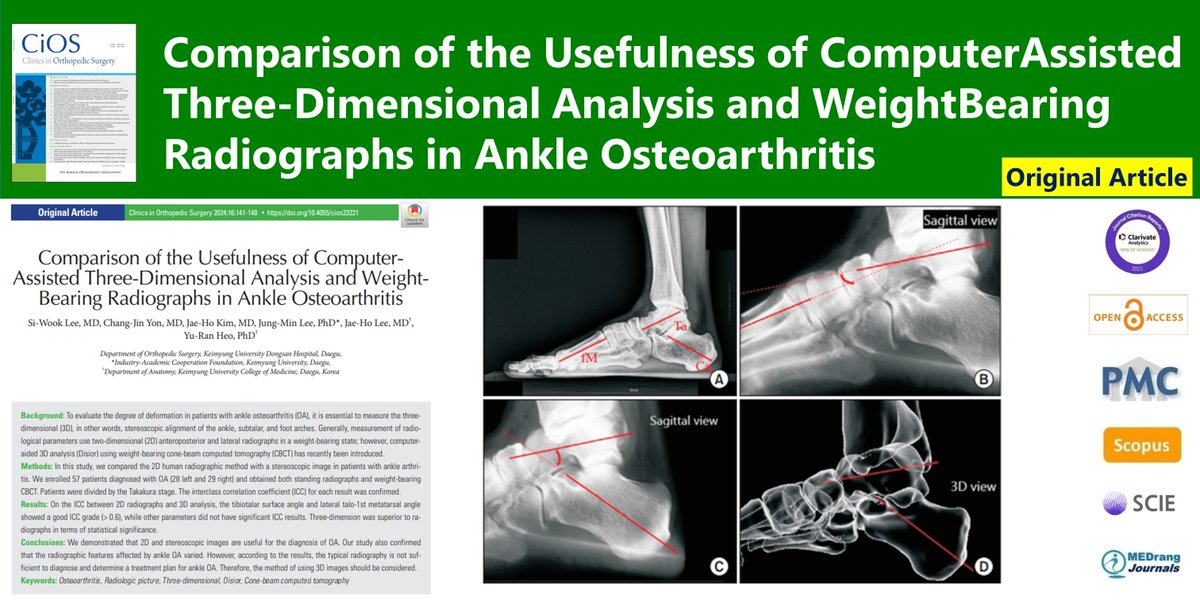 CiOSjournal's tweet photo. Comparison of the Usefulness of Computer-Assisted Three-Dimensional Analysis and Weight-Bearing Radiographs in Ankle Osteoarthritis
🌷https://t.co/JiIKQIPHBx
2024 Feb;16(1)Si-Wook Lee
#Osteoarthritis #Radiologic_picture #Three_dimensional #Disior #Cone_beam_computed_tomography https://t.co/MsgNPcLEMP