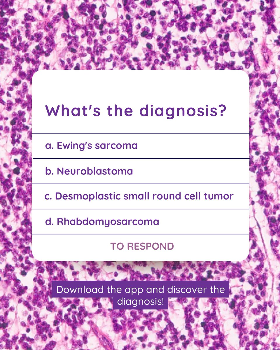 MDplusApp's tweet photo. Only well-trained eyes can see beyond! To further engage our community in a dynamic of constant learning, MD Plus features a section of questions and answers based on the presentation of high-definition slides within the app itself.

#mdplus #pathology https://t.co/h2VyObQTkz