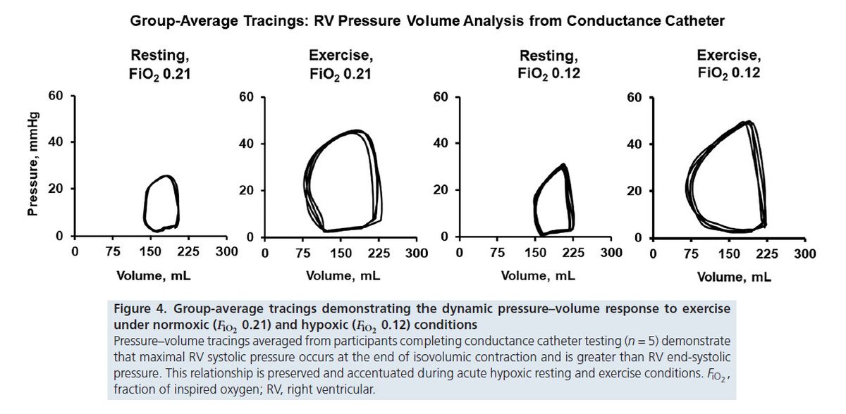 Forgotten no more! New clinical #pvloop study: 'Right Ventricular Performance during acute Hypoxic Exercise.' Link: physoc.onlinelibrary.wiley.com/doi/10.1113/JP… Congrats to all involved on this novel study! #hypoxia #peoplesventricle #heartfailure #cardiology #hemodynamics #pvloops @JPhysiol