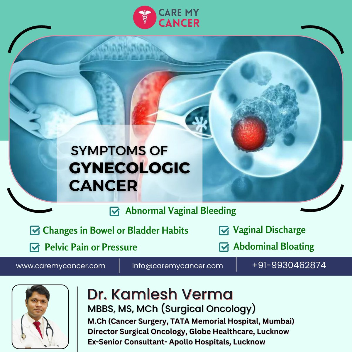 🔍 Recognizing the signs of gynecological cancer is crucial for early detection and treatment. 🩺 Learn more from Dr. Kamlesh Verma about the Symptoms of Gynecological Cancer. 

#WomensHealth #CancerAwareness #GynecologicalCancer  #Cancer #gynecological #Symptoms #DrKamleshVerma