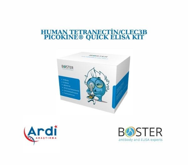 Human Tetranectin/CLEC3B PicoKine® Quick ELISA Kit

⚡SKU:FEK1253
⚡Boyut: 96 kuyu/kit, çıkarılabilir stripler ile.
⚡Reaktif Türler: İnsan
⚡Uygulama:ELISA
⚡Örnek Türleri: hücre kültürü süpernatantları ve serum
⚡Test Süresi: 90 Dakika