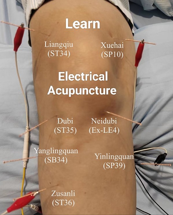 Learn Electrical Acupuncture 15th&16th JUNE 2024
with Dr Jon Marshall 
Enhance the efficacy of myofascial needling..
To book:
immcpd.co.uk

#acupuncture #pain #paincontrol #cpd
#needling #physicaltherapy
#dryneedling #medicalacupuncture
#cpd 
@fht_media
@fht_magazine