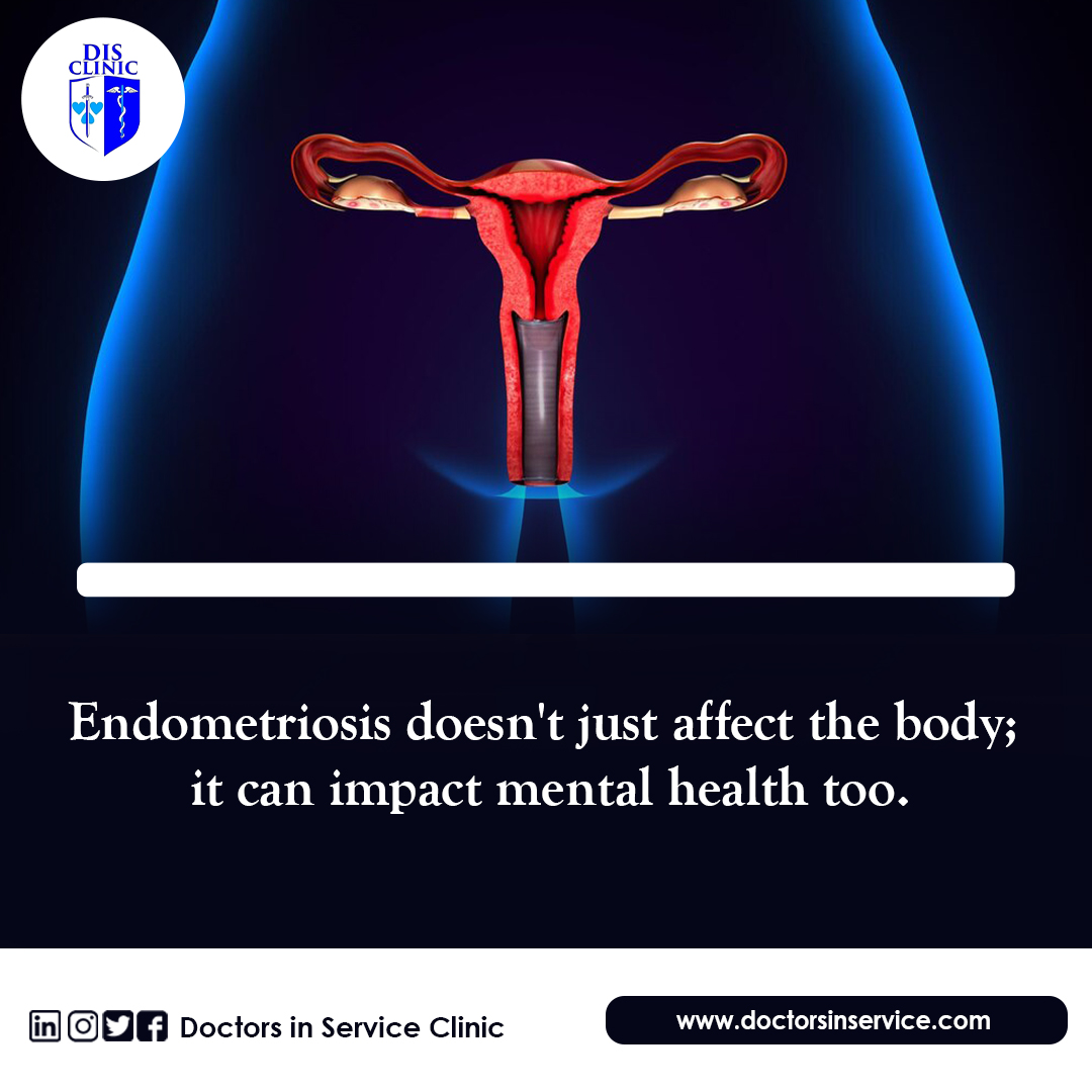 Endometriosis doesn't just affect the body; it can impact mental health too. #EndometriosisAwareness #mentalhealthmatters #mentalhealth