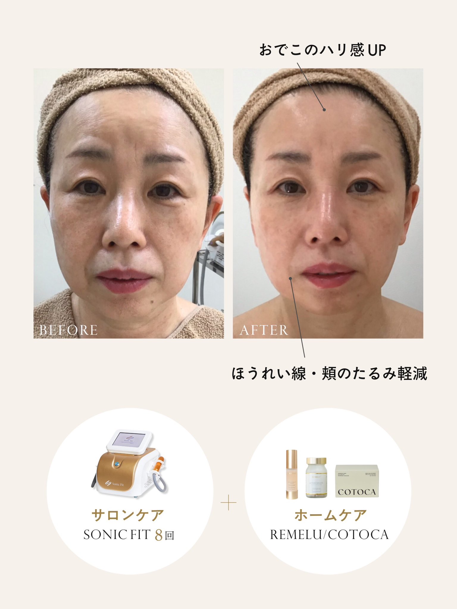リリーオン remelu ADVANCE PERFECT SERUM ADVANCE PERFECT SERUM（アドバンスパーフェクトセラム） – REMELU