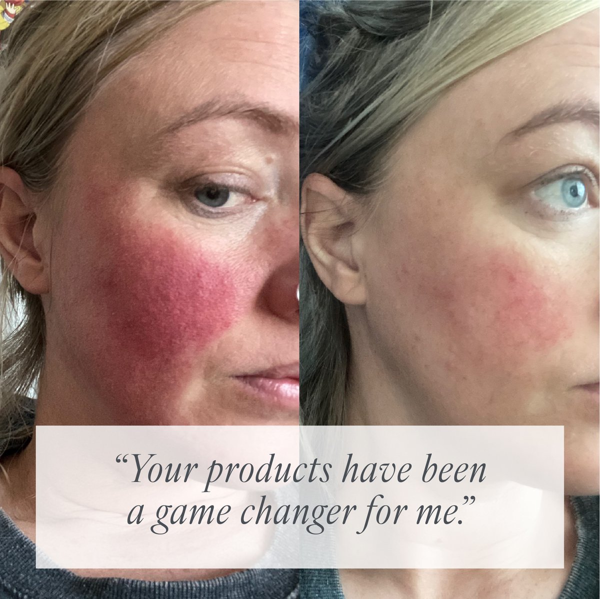 When creating the products our full focus was to create products that are effective and suitable for all skin types which make a difference to sensitive skin. Thought-out ingredients which soothe, hydrate and nourish but also change &amp; improve the skin in an effective way.