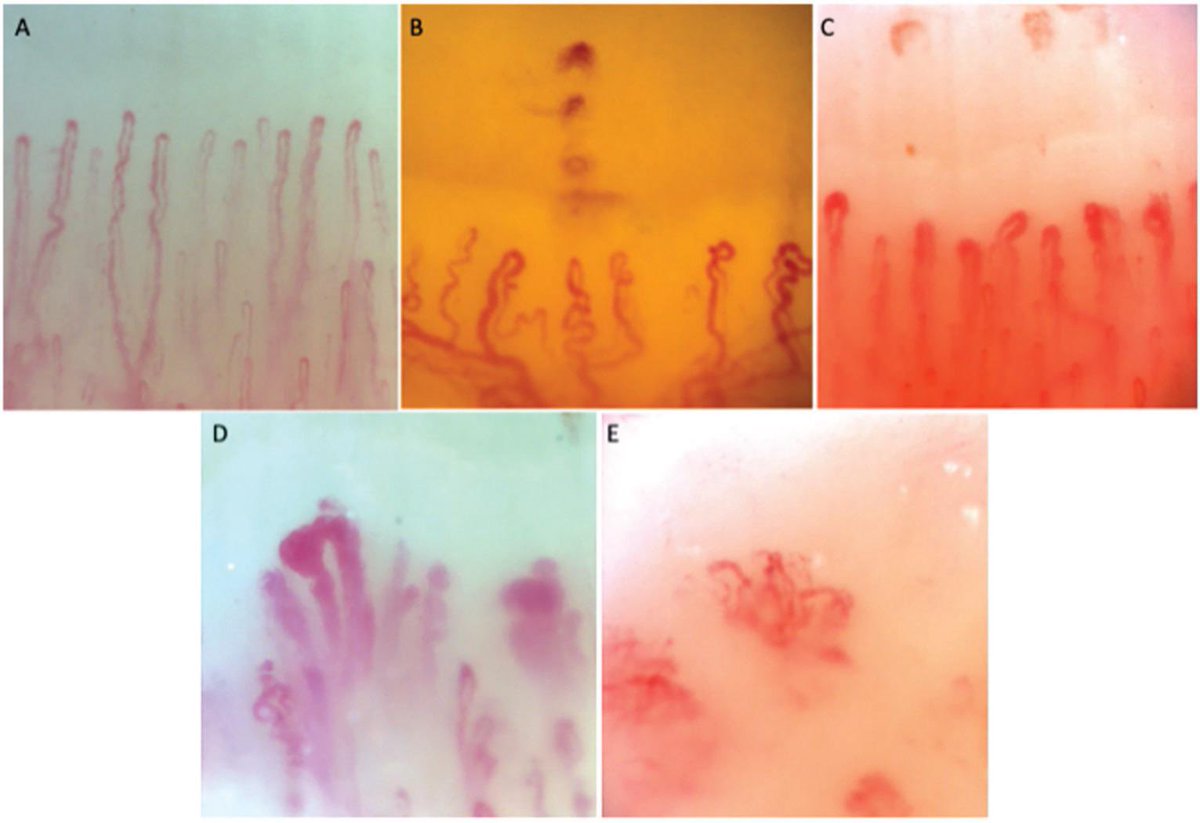 pubmed.ncbi.nlm.nih.gov/38488092/