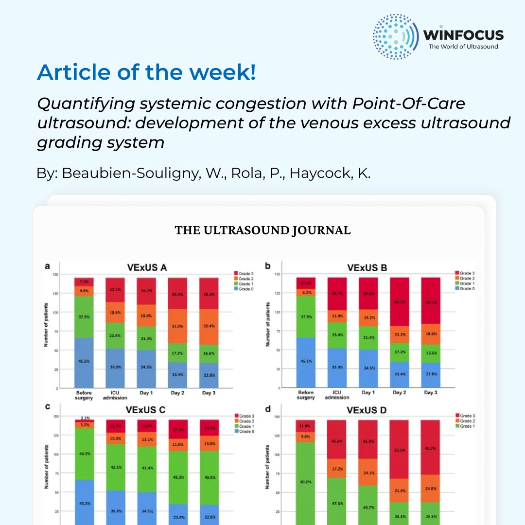 Article of the week: Quantifying systemic congestion with Point-Of-Care ultrasound: development of the venous excess ultrasound grading system. By: Beaubien-Souligny, W., Rola, P., Haycock, K. Link: rb.gy/wgf8eb #ultrasoundjournal #ultrasoundarticle #pocus #MedEd