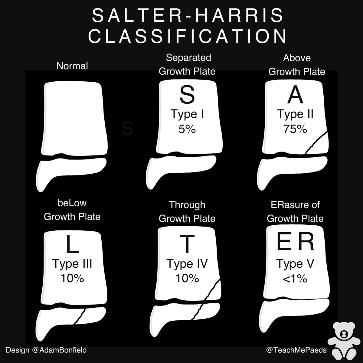 A reminder of those physis fracture types children 🦴 💥
#FOAMed #FOAMPEM