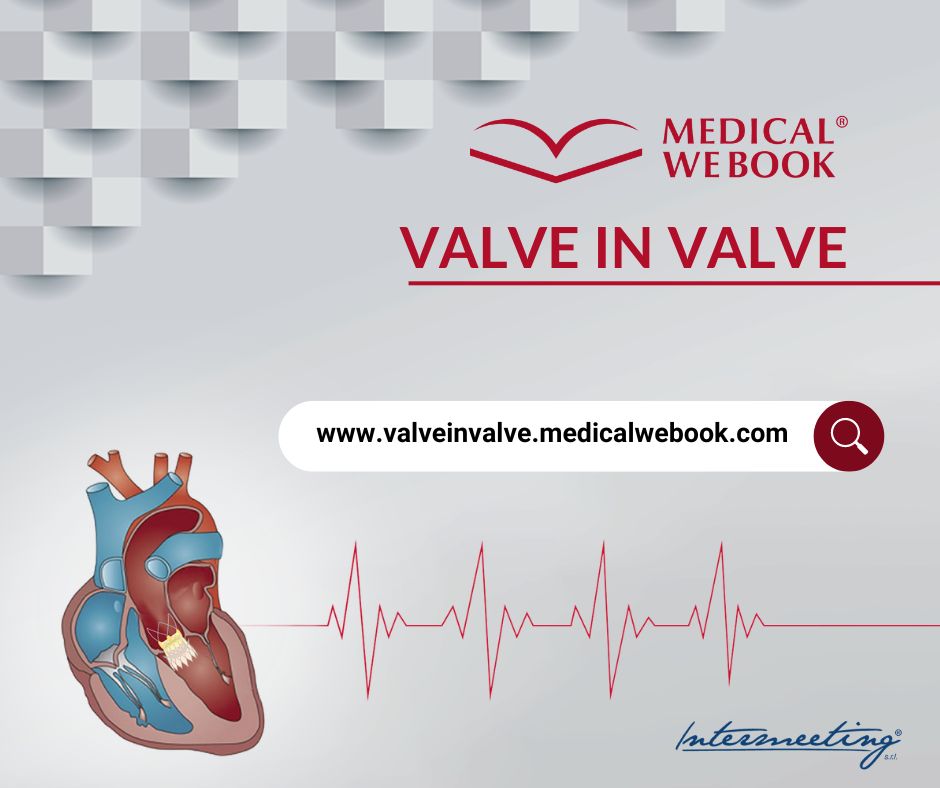 📢We are really happy to announce a new #digital project on #ValveinValve

Be one of the first readers. Create your free account here: ow.ly/7pjv50QSs0E

#TAVI #Valve #RedoTAVI #coronaryaccess #Cardiology #MedicalWeBook