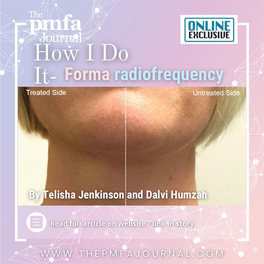 Curious about Forma radiofrequency treatment? Read the article by 𝐓𝐞𝐥𝐢𝐬𝐡𝐚 𝐉𝐞𝐧𝐤𝐢𝐧𝐬𝐨𝐧 and 𝐃𝐚𝐥𝐯𝐢 𝐇𝐮𝐦𝐳𝐚𝐡 to learn how this innovative procedure can boost #collagen growth and enhance skin's elasticity. 📚Read the full article: thepmfajournal.com/education/how-…