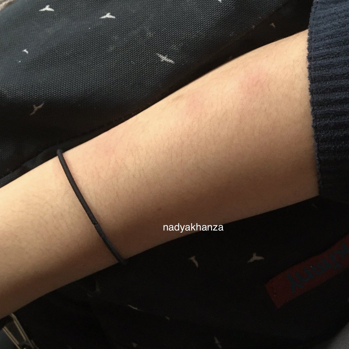 nadyakhanza's tweet image. ⚠️ TW KULIT GATAL

punya kulit yang banyak bekas gigitan nyamuk atau bekas menghitam?

aku saranin bisa cobain produk EXFO buat mandi dan bisa dipakai setiap hari..!!!
udah mau sebulan pakai ini cocok gak kambuh lagi, sekaligus ini bikin kulit jadi lebih lembab!