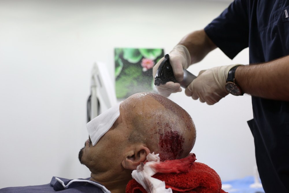HairTurk's tweet photo. فلوريا كلينك التخصصي في عمليات #زراعة_الشعر_في_تركيا، اكثر من 30 الف عملية ناجحة لدى العرب.

للاستعلام يرجى الاتصال: https://t.co/sfdvZQvkmY #إسطنبول #تركيا https://t.co/KBJIep1ppW