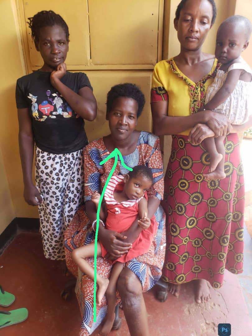 THREAD: Never joke with NUTRITION . It is the only remedy that can bring full recovery and can be used with any treatment. Remember, food is our best medicine. Agnes, a resident of Kyambazzi village got an accident when she was six months pregnant.