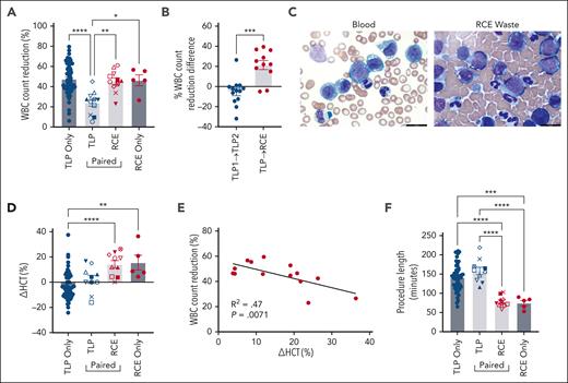 Red cell exchange for rapid leukoreduction in adults with hyperleukocytosis and leukostasis
ow.ly/KK4g50QTEUt #myeloidneoplasia #transfusionmedicine