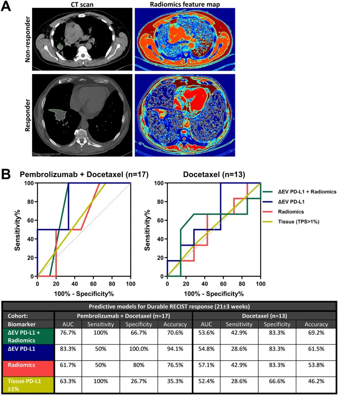 JournalofExper1's tweet photo. New!📌

Validation of a multiomic model of #plasmaextracellularvesicle PD-L1 and radiomics for prediction of response to #immunotherapy in NSCLC

Look here⤵️
https://t.co/KpKIH7aQO2

#LungCancer
#Immunecheckpointinhibitor
#LiquidBiopsy
@ChristianRolfo https://t.co/5mGYzVH0qO