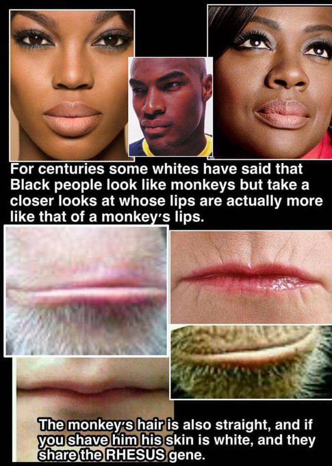Dear white racists … please seek help 😭