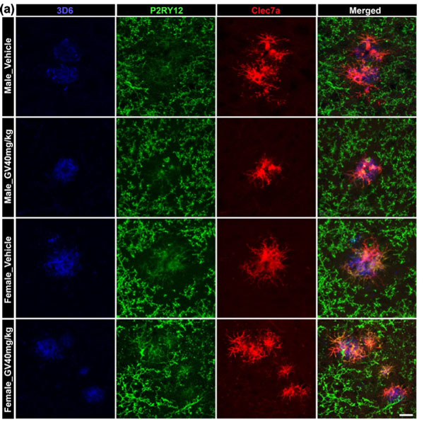 #mustread Our anti-P2RY12 and Alzheimer's disease. Discover more: ow.ly/Vfee50QWuXp #Alzheimers #atlasantibodies #antibodies #TripleAPolyclonals #neuroscience