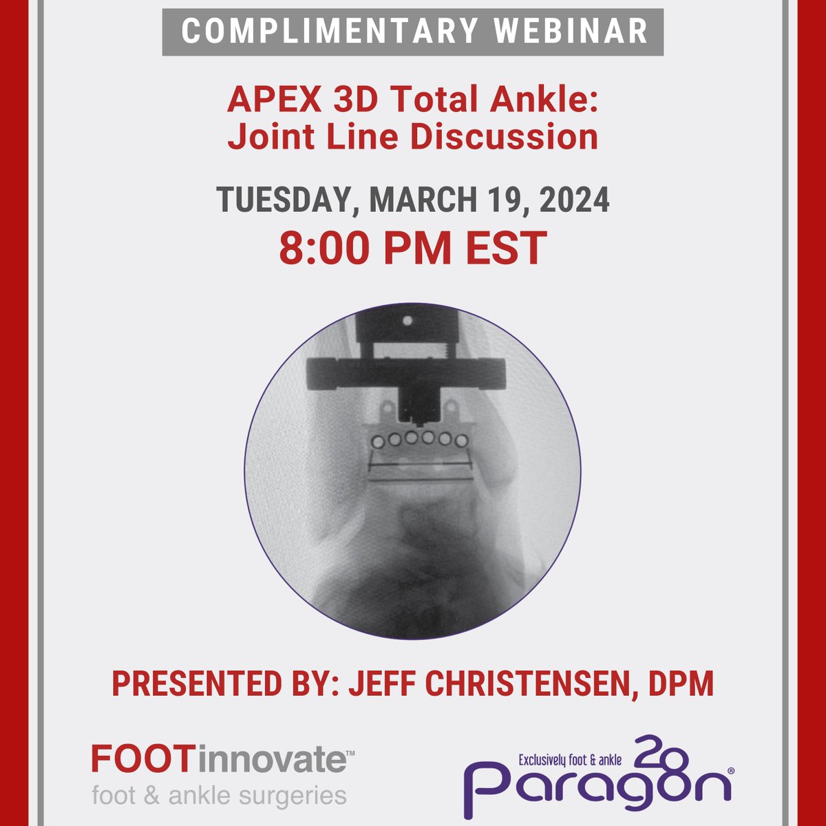 FootInnovate's tweet image. APEX 3D - Total Ankle - Joint Line Discussion
WEBINAR REGISTRATION: ow.ly/6Wwn50QM7P4

Join us today for this  Foot Innovate-Paragon 28 Corporate Webinar  with Dr. Jeffrey Christensen at 8:00 pm EST

#TotalAnkleReplacement #FootAndAnkleSurgeryt #Podiatry #OrthopaedicSurgery