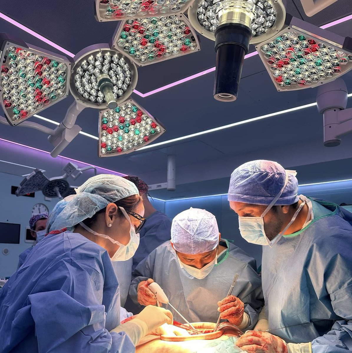 DocFundora (@yiliamfundora) on Twitter photo La formación de los médicos residentes y fellows es una prioridad para el equipo de Cirugía HBP y Trasplante en el Hospital Clinic de Barcelona
<a href="/hospitalclinic/">Hospital Clínic</a> <a href="/clinic/">Health Clinic</a> La formación de los médicos residentes y fellows es una prioridad para el equipo de Cirugía HBP y Trasplante en el Hospital Clinic de Barcelona
<a href="/hospitalclinic/">Hospital Clínic</a> <a href="/clinic/">Health Clinic</a>