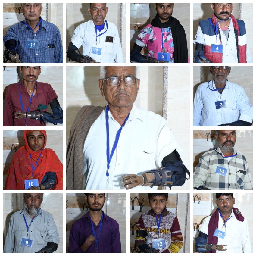 rtnmohan's tweet photo. "Every hand deserves to hold onto their dreams, and that's exactly what the LN-4 Prosthetic Hand Camp in Bikaner, Rajasthan was all about. On 17th March 2024, we witnessed the power of empathy as Rotarians came together to provide prosthetic hands to those in need. https://t.co/Tn47ayDwmo