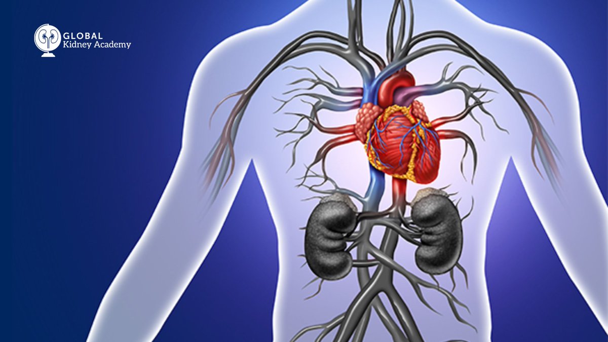 How can we manage #hyperkalemia in patients with #CKD and #heartfailure? We’re discussing key data from clinical trials focused on the efficacy of currently available potassium binders in this free #CME activity: ow.ly/7FvG50QMzEL #MedTwitter #AskRenal @md_ellie