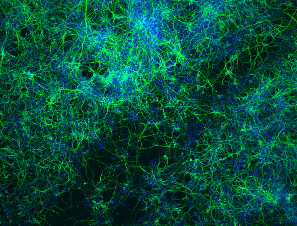 The lab is finally starting to see some encouraging results in getting corticospinal neurons to grow in response to a specific drug compound.  (control on left, treated on right)