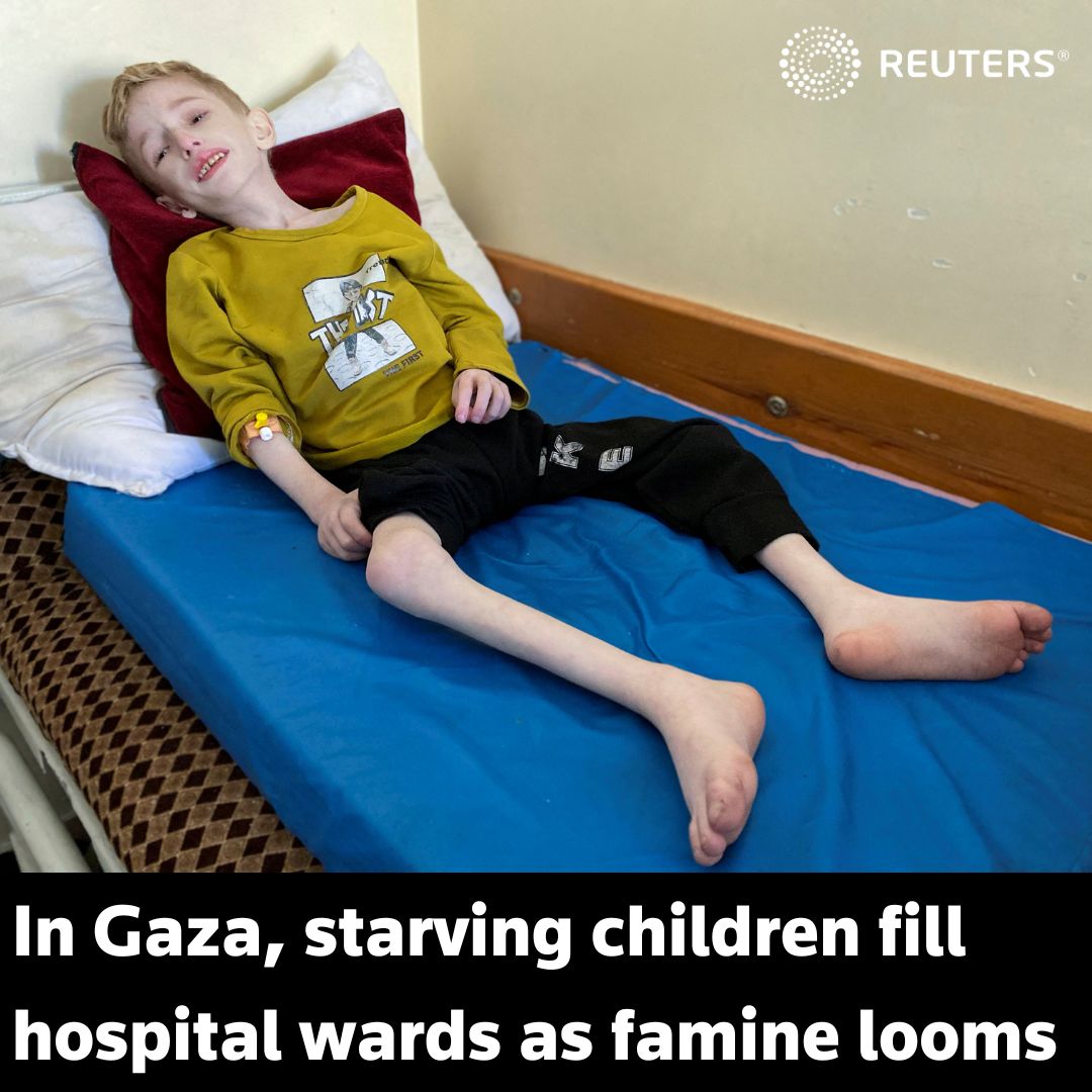 Six-year-old Fadi al-Zant is acutely malnourished, his ribs protruding under leathery skin, his eyes sunken as he lays in bed at the Kamal Adwan hospital in northern Gaza, where famine is bearing down reut.rs/3PoSM8g 1/7
