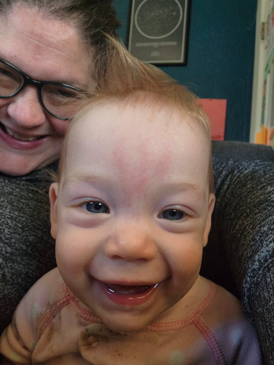 Hair there and everywhere 🤣

#hair #baby #cute #spike