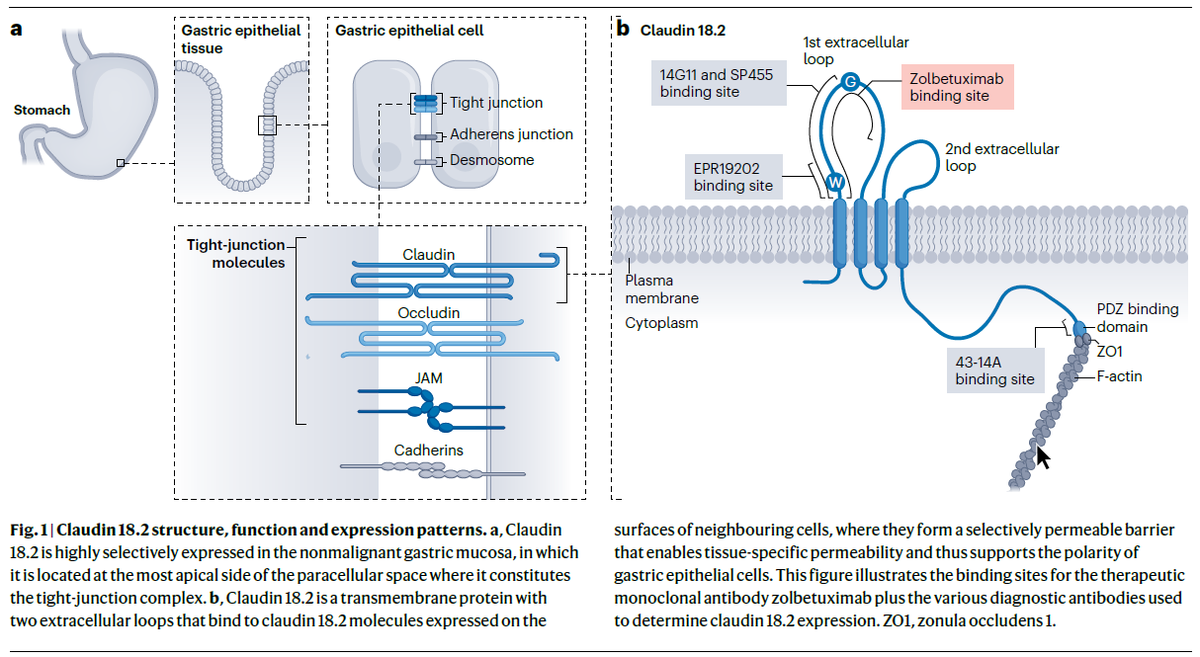 NatRevClinOncol's tweet photo. In a new Review, Izuma Nakayama, Changsong Qi, Yang Chen, Yoshiaki Nakamura, Lin Shen & Kohei Shitara discuss Claudin 18.2 as a novel target for cancer therapy: https://t.co/AHL5heVs6K https://t.co/8sVkR2wnT7