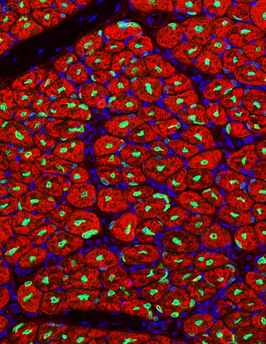 News: Research from the Sartorelli lab at NIAMS suggest potential therapeutic interventions to improve muscle regeneration during aging. 🔒 Published in @genesdev. Read the abstract: pubmed.ncbi.nlm.nih.gov/38453480/ #AKG #MouseModels | @nih_nhlbi supported