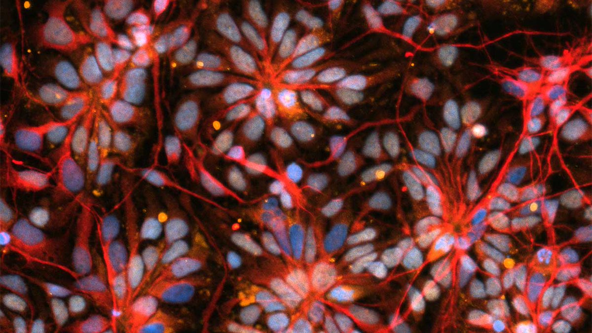 ISS_CASIS's tweet image. To better understand #neurodegenerative diseases like #parkinsons and #ms, researchers from the @nationalscf are sending miniature 3D models of the human brain to the @Space_station. Research results could ultimately benefit millions of people worldwide: ow.ly/6mL150QWQcF