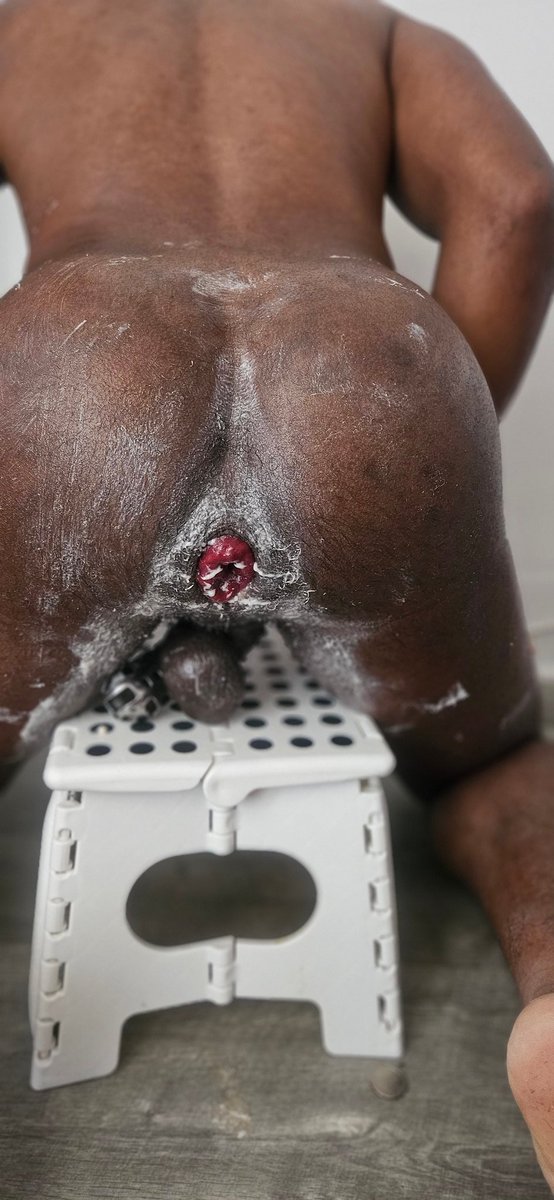 Guy_FFUN's tweet photo. Today tools of ass destruction #FF #blackfisting #gayfisting https://t.co/DkHvRfkUki