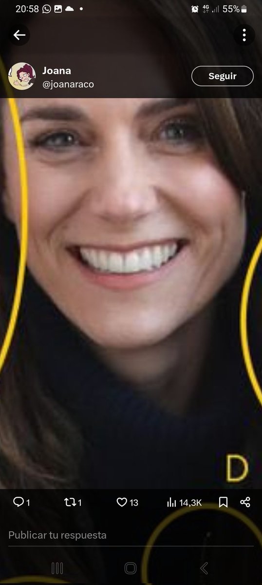 OwaidatF's tweet photo. @joanaraco Hola, posiblemente sea porque le han quitado las carillas si ha estado ingresada o intubada, pero los dientes no tienen nada que ver https://t.co/3HvbkAFGMB