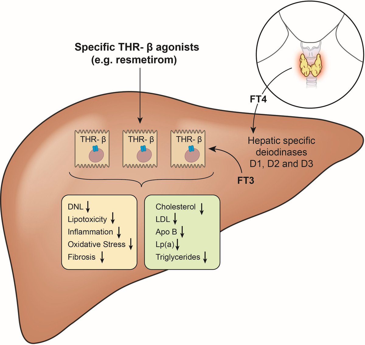 #GUTImage from the #LeadingArticle paper by Byrne et al entitled 'Thyroid hormone receptor-beta agonists: new MASLD therapies on the horizon' via bit.ly/3vdfuJH #MASLD